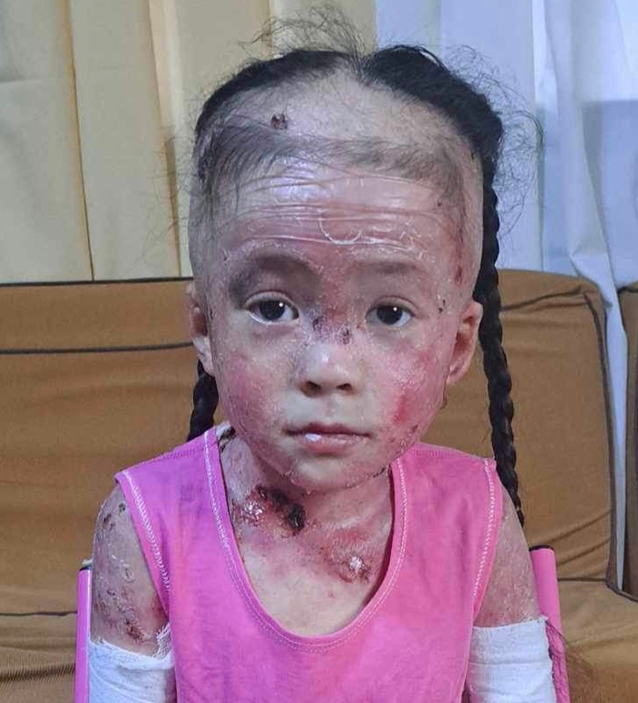 Please Donate To Stop Nathania's Severe Pain And Help Save Her Life!