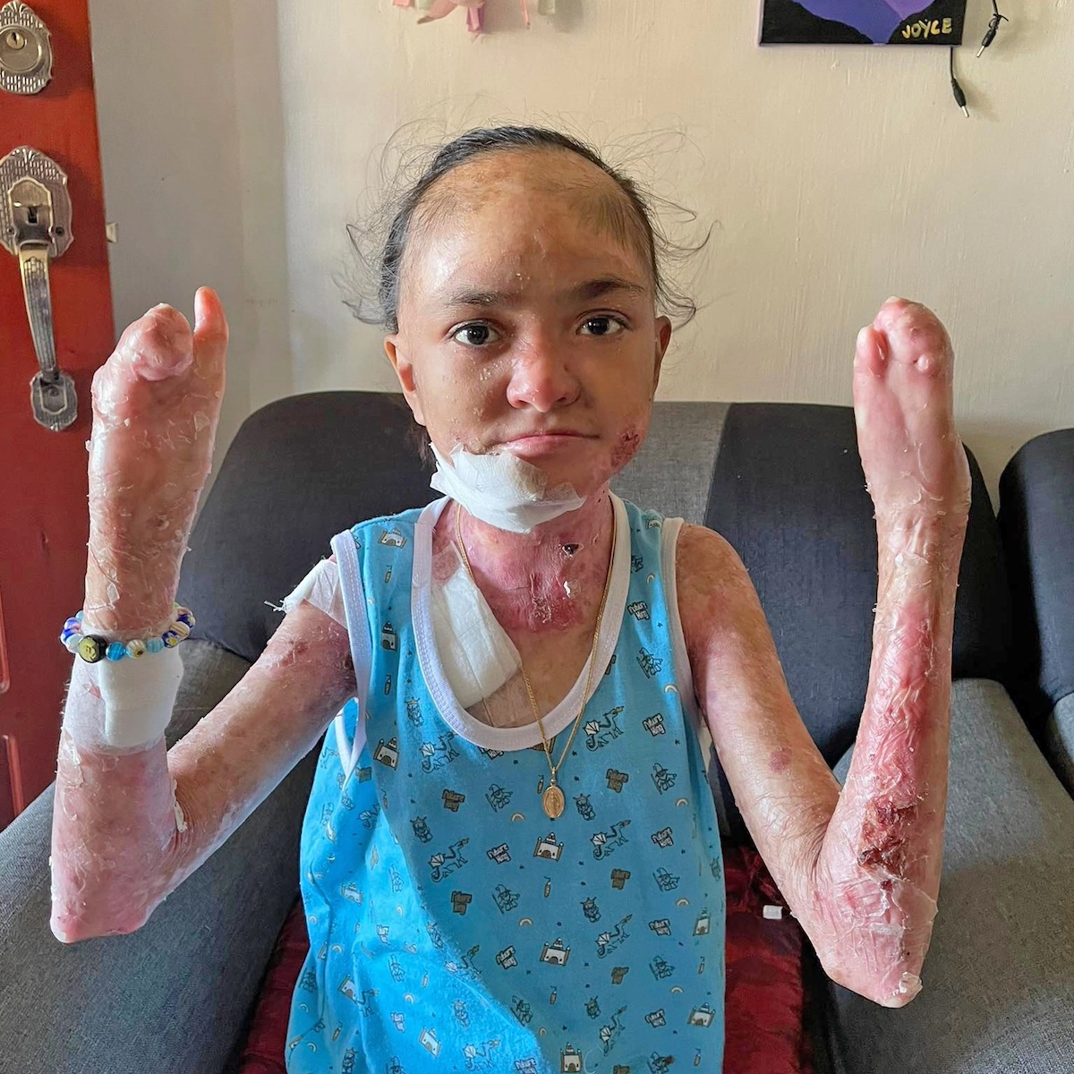 Please Help Reduce Baby Joyce's Severe Pain