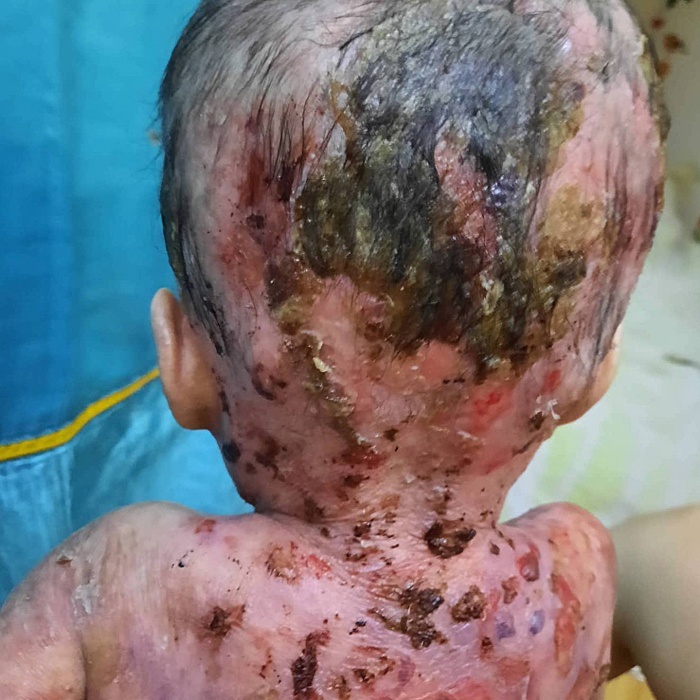 Please Donate to Stop Lily's Severe Pain and Help Save Her Life — photo 2